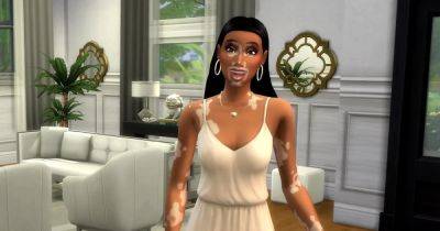 Free Sims 4 update adds Vitiligo skin details with Winnie Harlow collaboration - eurogamer.net